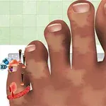 왼쪽 새끼발가락에 못과 상처가 있는 커다란 발 모습